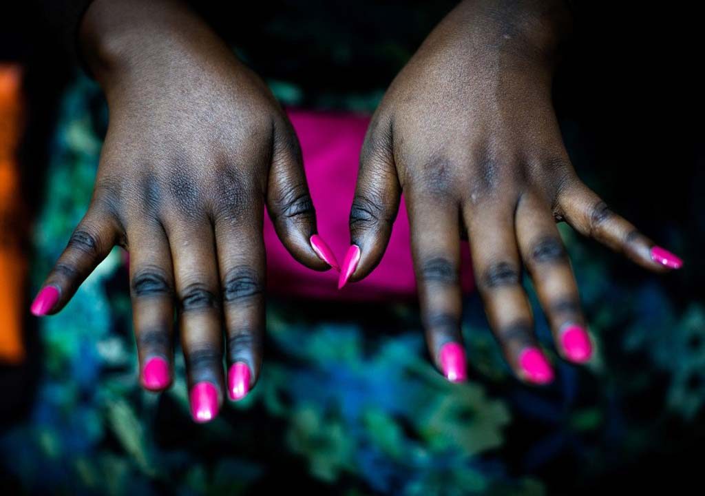 6 Negative Health Effects Of Bleaching Skin